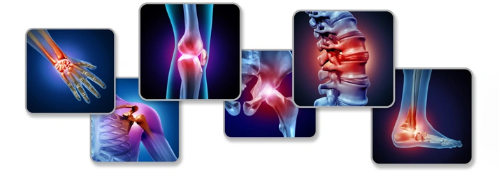 Collage of highlighted joint pain areas